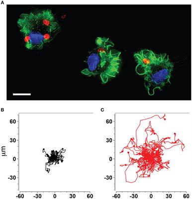 diabetes toxoplasma gondii